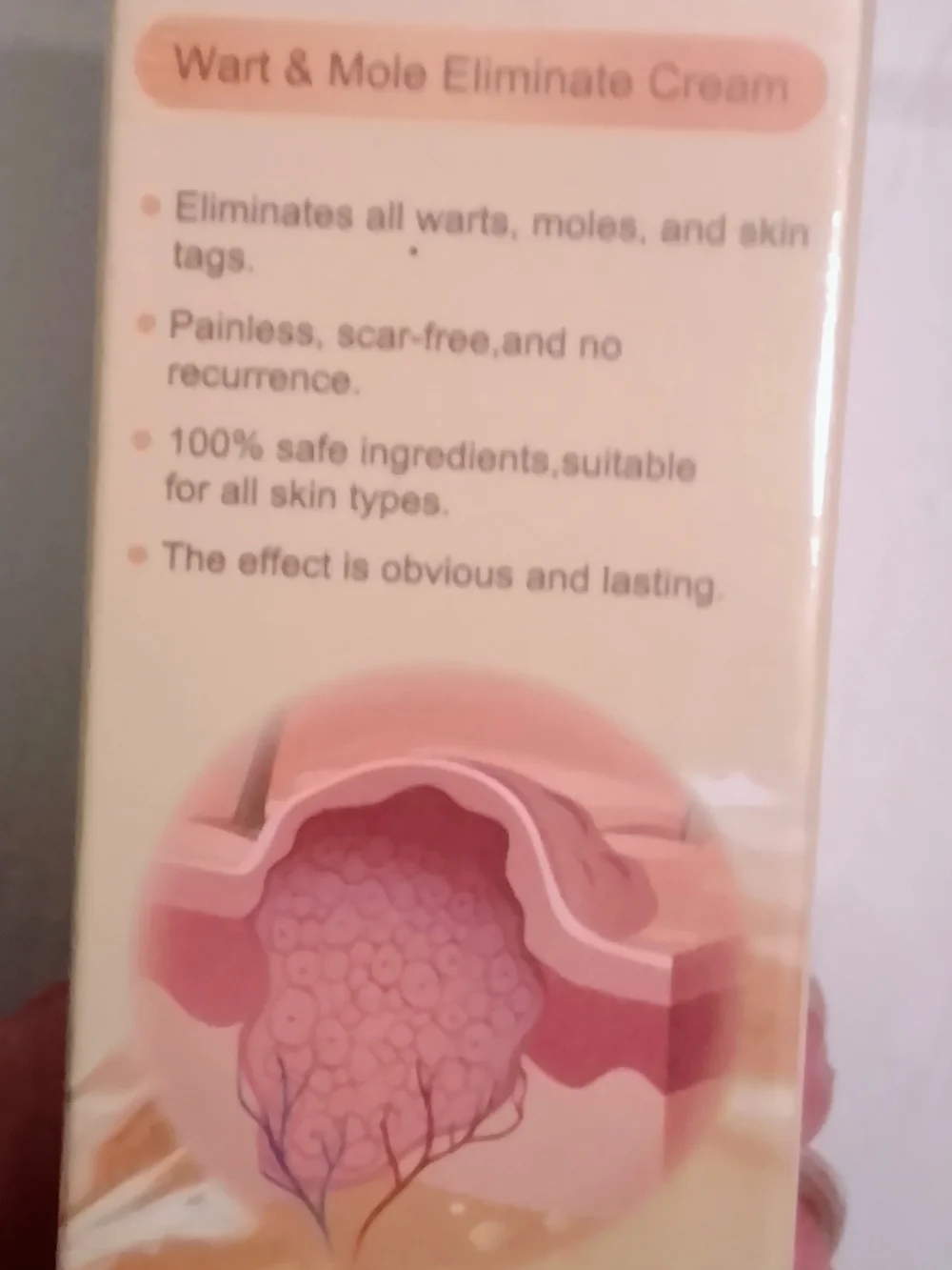 Ximonth Bee Venom Wart & Mole Eliminate Cream Set Of 2